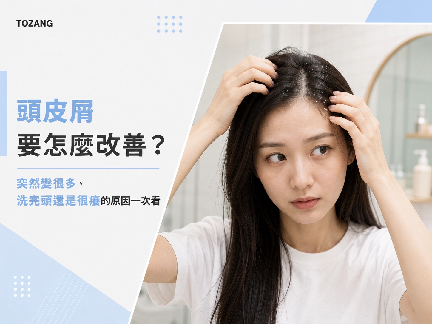 頭皮屑要怎麼改善？突然變很多、洗完頭還是很癢的原因一次看
